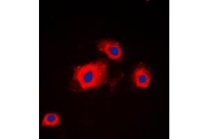 Immunofluorescent analysis of PI3K p85 alpha/p55 gamma staining in HeLa cells. (PIK3R3 antibody  (Center))