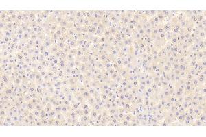 Detection of MSP in Rat Liver Tissue using Polyclonal Antibody to Macrophage Stimulating Protein (MSP) (MST1 antibody  (AA 489-716))