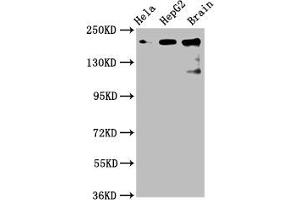 Western Blot Positive WB detected in: Hela whole cell lysate, HepG2 whole cell lysate, Rat brain tissue All lanes: CKAP5 antibody at 6 μg/mL Secondary Goat polyclonal to rabbit IgG at 1/50000 dilution Predicted band size: 226, 219, 227 kDa Observed band size: 226 kDa (CKAP5 antibody  (AA 1802-2019))