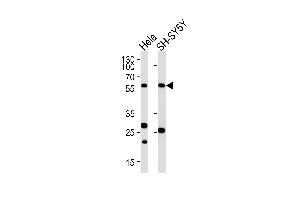 Western blot analysis of lysates from Hela,SH-SY5Y cell line (from left to right),using CALR Antibody (ABIN484301 and ABIN1533682). (Calreticulin antibody)