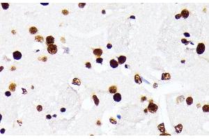Immunohistochemistry (Paraffin-embedded Sections) (IHC (p)) image for anti-Heterogeneous Nuclear Ribonucleoprotein D (HNRNPD) antibody (ABIN7258580)