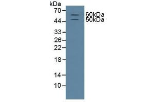 Detection of CD15 in Rat Brain Tissue using Polyclonal Antibody to Cluster Of Differentiation 15 (CD15) (CD15 antibody  (AA 264-497))