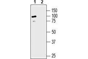 Western blot analysis of human HepG2 liver hepatocellular carcinoma: - 1. (SLC6A8 antibody  (C-Term, Extracellular))