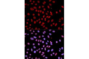 Immunofluorescence analysis of U2OS cells using PTPN6 antibody (ABIN5970673). (SHP1 antibody)
