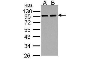 WB Image Sample (30 ug of whole cell lysate) A: NIH-3T3 B: JC 7. (ACTN3 antibody  (Center))