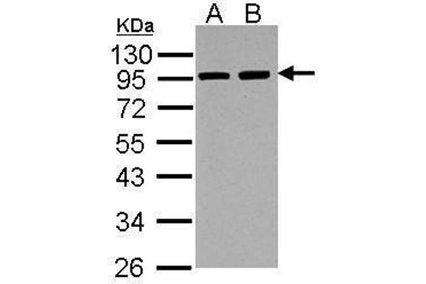 ACTN3 antibody  (Center)