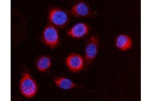 IF analysis of ARFGAP1 using anti-ARFGAP1 antibody (ABIN4886474). (ARFGAP1 antibody  (AA 1-183))