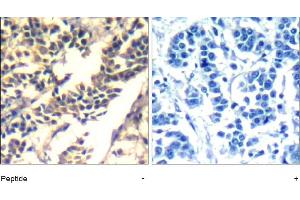 Image no. 1 for anti-Cas-Br-M (Murine) Ecotropic Retroviral Transforming Sequence (CBL) (Tyr700) antibody (ABIN401654) (CBL antibody  (Tyr700))