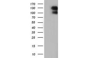 Image no. 1 for anti-Microtubule Associated Monoxygenase, Calponin and LIM Domain Containing 1 (MICAL1) antibody (ABIN1499462) (MICAL1 antibody)