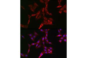Immunofluorescence (IF) image for anti-Transferrin Receptor (p90, CD71) (TFRC) (AA 1-140) antibody (ABIN6149065)