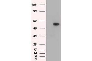 HEK293T cells were transfected with the pCMV6-ENTRY control (Left lane) or pCMV6-ENTRY TBXAS1 (Right lane) cDNA for 48 hrs and lysed. (TBXAS1 antibody)