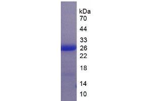 SDS-PAGE analysis of Human LILRB3 Protein.