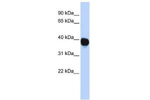 WB Suggested Anti-TPST2 Antibody Titration:  0. (TPST2 antibody  (Middle Region))