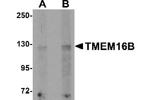 Western blot analysis of TMEM16B in rat brain tissue lysate with TMEM16B antibody at (A) 1 and (B) 2 µg/mL. (Anoctamin 2 antibody  (N-Term))