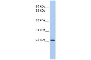 WB Suggested Anti-ZNF833P Antibody Titration:  0. (LOC401898 antibody  (N-Term))