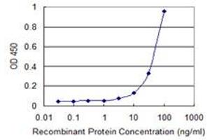 Detection limit for recombinant GST tagged ZSCAN1 is 1 ng/ml as a capture antibody. (ZSCAN1 antibody  (AA 315-407))