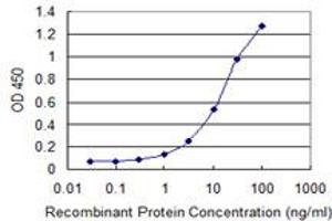 Detection limit for recombinant GST tagged NAT5 is 0. (NAT5 antibody  (AA 1-178))