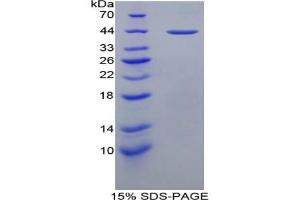 SDS-PAGE of Protein Standard from the Kit (Highly purified E.