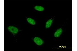 Immunofluorescence of monoclonal antibody to NFYB on HeLa cell.