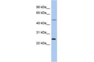 Image no. 1 for anti-Chymotrypsinogen B1 (CTRB1) (N-Term) antibody (ABIN6742409) (CTRB1 antibody  (N-Term))