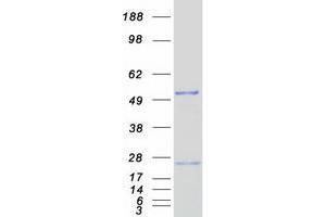 Western Blotting (WB) image for Nudix (Nucleoside Diphosphate Linked Moiety X)-Type Motif 12 (NUDT12) protein (Myc-DYKDDDDK Tag) (ABIN2727744)