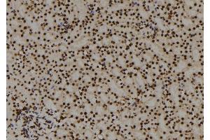 ABIN6278676 at 1/100 staining Mouse kidney tissue by IHC-P.