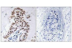 Immunohistochemistry (IHC) image for anti-Death-Associated Protein Kinase 3 (DAPK3) (Thr265) antibody (ABIN1848018) (DAPK3 antibody  (Thr265))