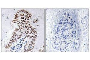Immunohistochemistry (IHC) image for anti-Death-Associated Protein Kinase 3 (DAPK3) (Thr265) antibody (ABIN1848018)