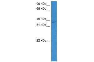 WB Suggested Anti-STEAP1 Antibody Titration: 0. (STEAP1 antibody  (N-Term))