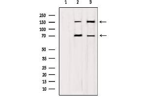 Western blot analysis of extracts from various samples, using mDia1 Antibody. (DIAPH1 antibody)