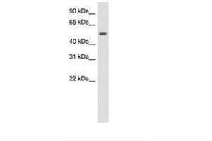 Image no. 1 for anti-Death Inducer-Obliterator 1 (DIDO1) (N-Term) antibody (ABIN6736175)