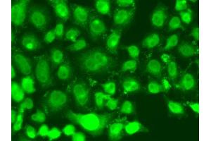 Immunofluorescence analysis of A549 cells using TSEN2 antibody (ABIN5975732). (TSEN2 antibody)