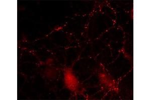 Indirect immunostaining of cultured hippocampus neurons (dilution 1 : 200). (SV2B antibody  (AA 2-17))