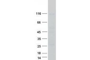 Validation with Western Blot (AGLU Protein (Transcript Variant 2) (Myc-DYKDDDDK Tag))