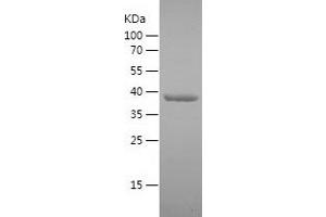 Western Blotting (WB) image for DEAD (Asp-Glu-Ala-Asp) Box Polypeptide 3, Y-Linked (DDX3Y) (AA 196-372) protein (His-IF2DI Tag) (ABIN7283798) (DDX3Y Protein (AA 196-372) (His-IF2DI Tag))