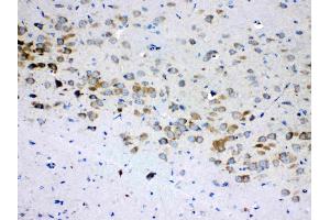 IHC analysis of RPS6 using anti- RPS6 antibody . (RPS6 antibody  (N-Term))