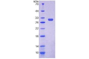 SDS-PAGE (SDS) image for Autocrine Motility Factor Receptor (AMFR) (AA 456-639) protein (His tag) (ABIN6238725) (AMFR Protein (AA 456-639) (His tag))