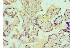 Immunohistochemistry of paraffin-embedded human placenta tissue using ABIN7156372 at dilution of 1:100 (IGFBP4 antibody  (AA 22-258))