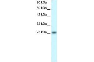 WB Suggested Anti-MXD4 Antibody Titration:  0. (MXD4 antibody  (N-Term))