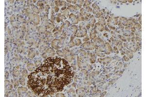 ABIN6276945 at 1/100 staining Human pancreas tissue by IHC-P. (IL1R2 antibody  (C-Term))