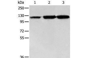 Western Blot analysis of PC3 cell, Human colon cancer and liver cancer tissue using HSP105 Polyclonal Antibody at dilution of 1:500 (HSPH1 antibody)
