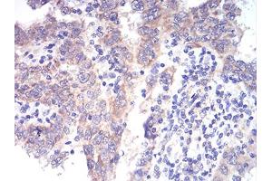 Immunohistochemistry (IHC) image for anti-Aldehyde Dehydrogenase 6 Family, Member A1 (ALDH6A1) (AA 1-195) antibody (ABIN5856297) (ALDH6A1 antibody  (AA 1-195))
