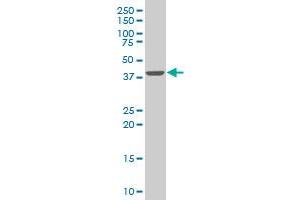 SMARCB1 monoclonal antibody (M03), clone 3C4 Western Blot analysis of SMARCB1 expression in Hela S3 NE . (SMARCB1 antibody  (AA 81-180))