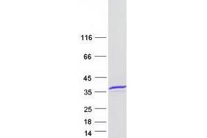 Validation with Western Blot