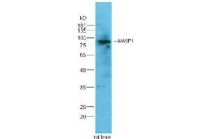 Rat brain lysates probed with Rabbit Anti-MASP Polyclonal Antibody  at 1:5000 90min in 37˚C. (MASP1 antibody  (AA 20-120))