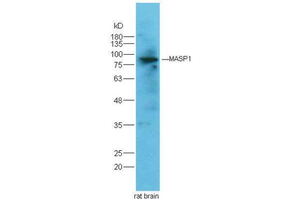 MASP1 antibody  (AA 20-120)