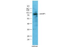 MASP1 Antikörper  (AA 20-120)