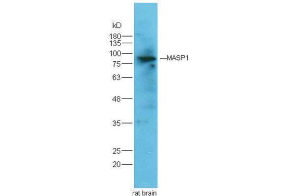 MASP1 抗体  (AA 20-120)