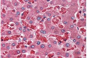 Human Liver (formalin-fixed, paraffin-embedded) stained with A2M antibody ABIN396916 at 10 ug/ml followed by biotinylated goat anti-rabbit IgG secondary antibody ABIN481713, alkaline phosphatase-streptavidin and chromogen. (alpha 2 Macroglobulin antibody  (C-Term))