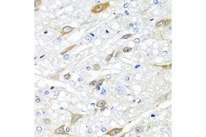 Immunohistochemistry of paraffin-embedded rat brain using CP antibody (ABIN6129673, ABIN6138930, ABIN6138932 and ABIN6217722) at dilution of 1:100 (40x lens). (CPA6 antibody  (AA 130-437))